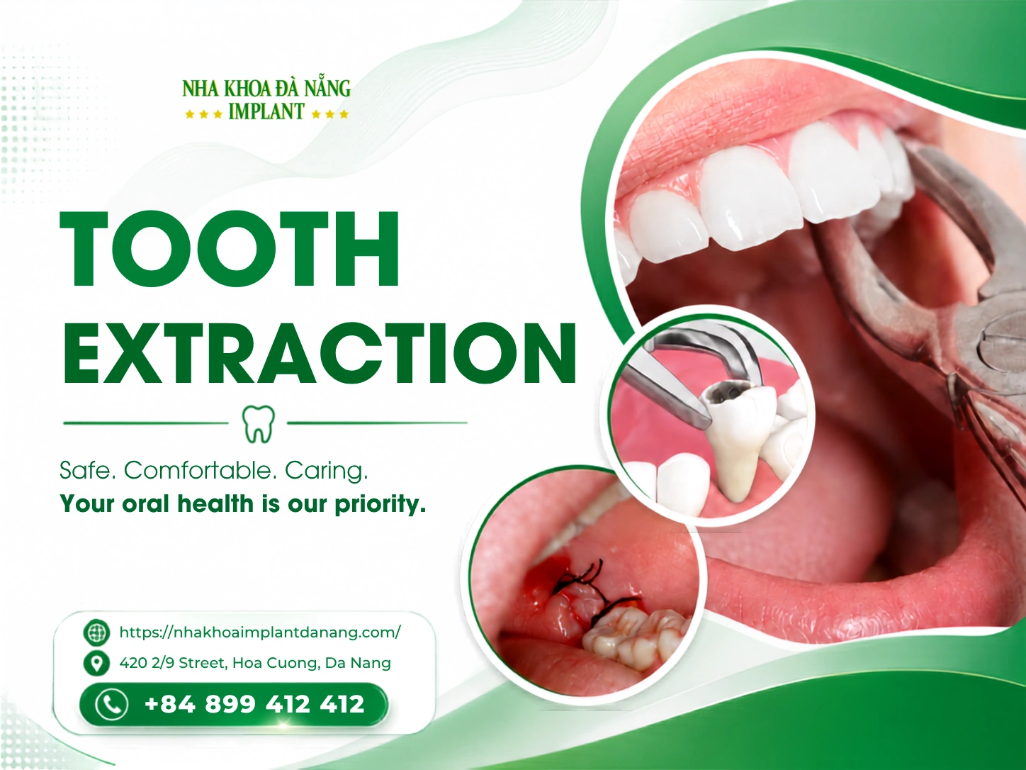 Tooth extraction
