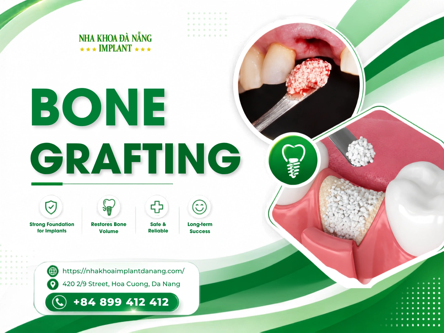 Dental bone graft