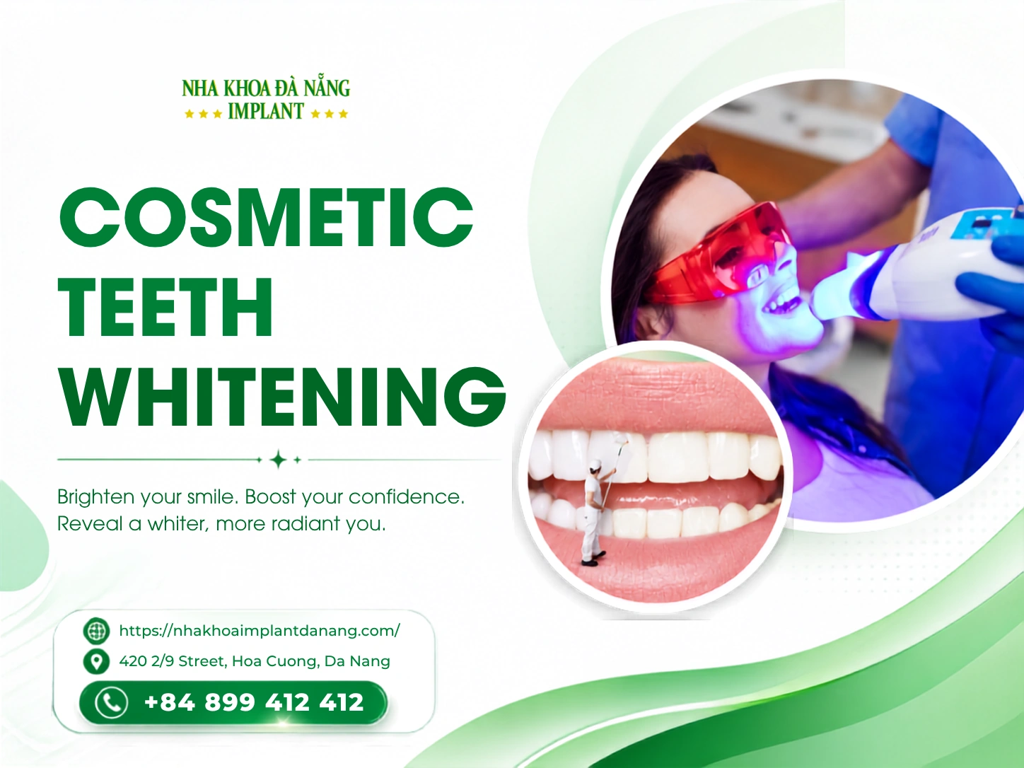 Cosmetic teeth whitening
