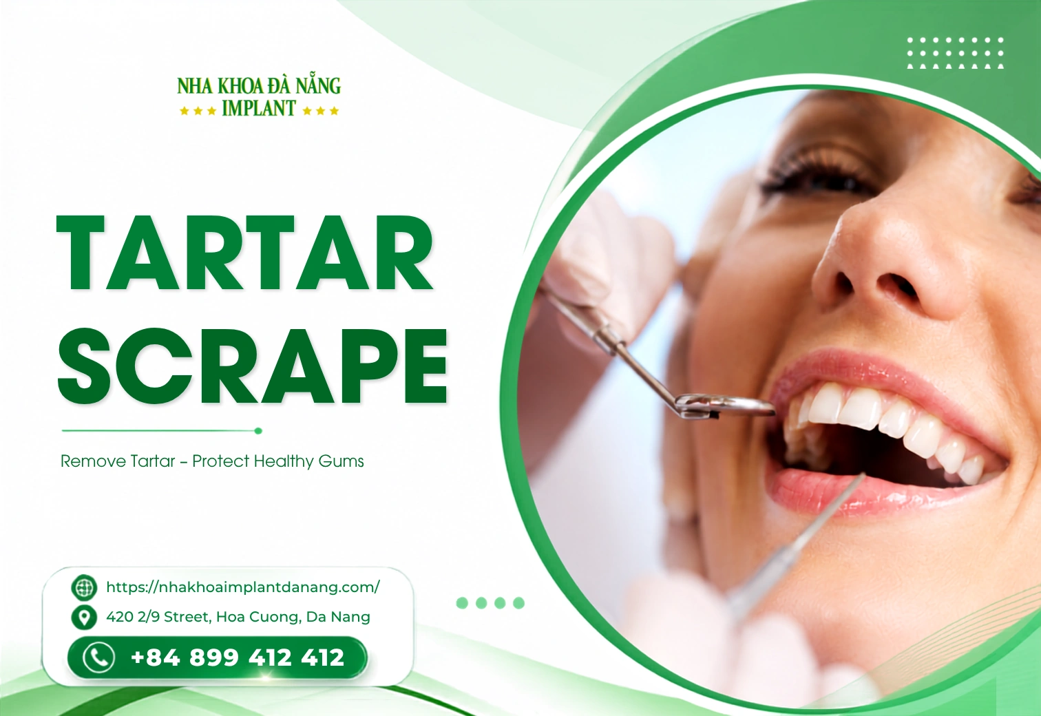 Tartar Scrape
