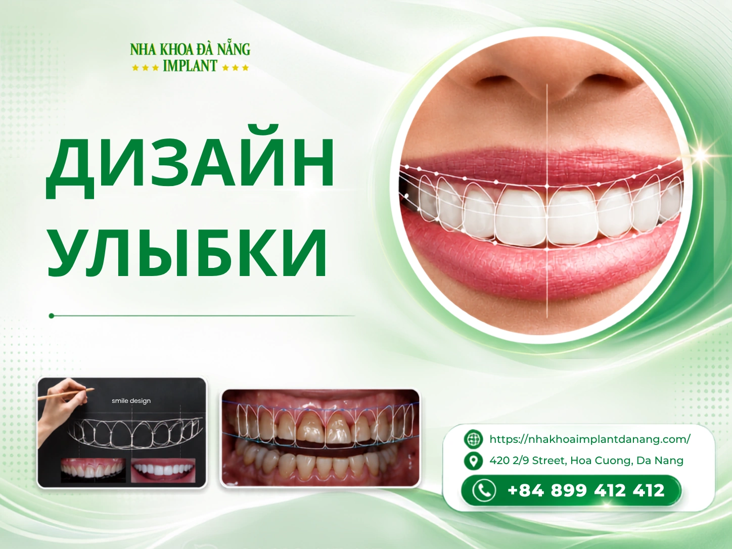 Дизайн улыбки