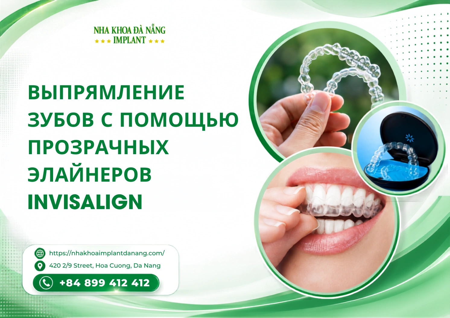 Выпрямление зубов с помощью прозрачных элайнеров Invisalign