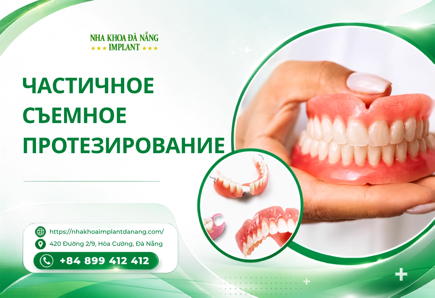 Частичное съемное протезирование