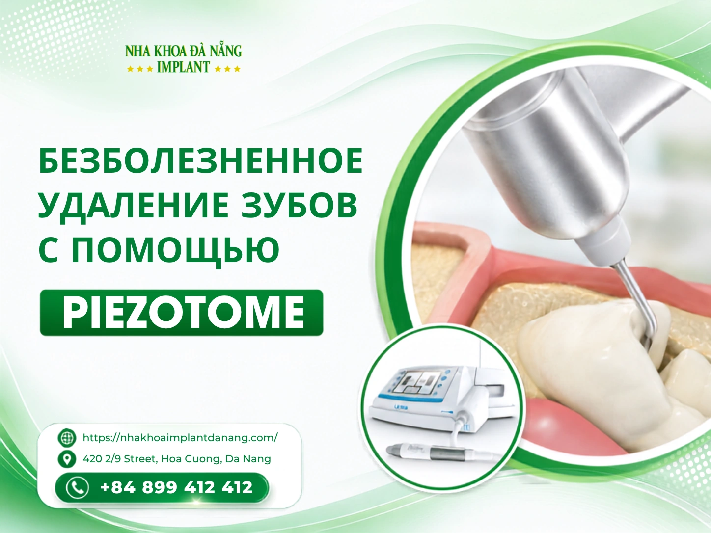 Безболезненное Удаление Зубов С Помощью Piezotome