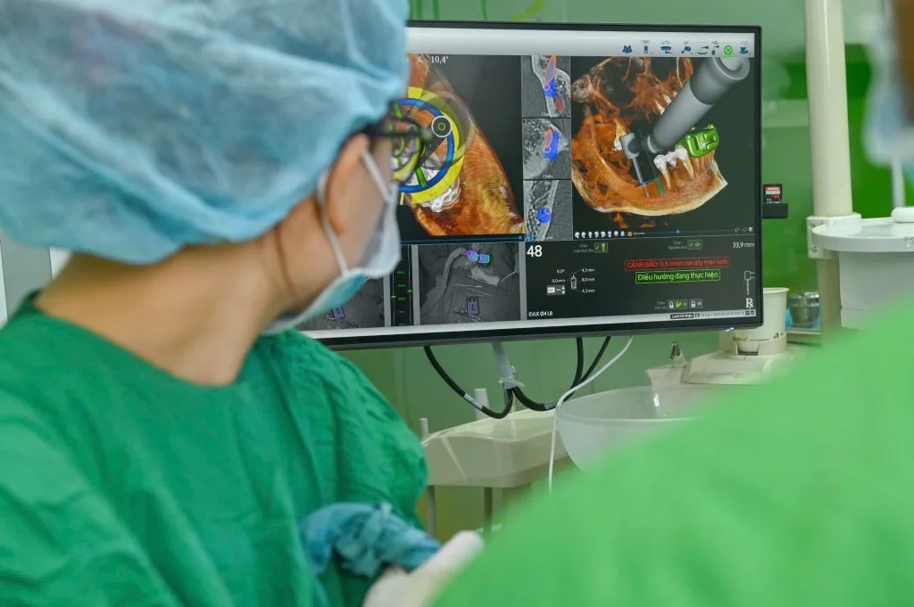 Giải pháp trồng răng Implant an toàn tại Đà Nẵng với "GPS nha khoa" X-Guide – Giá mới nhất 2025 9 Giải pháp trồng răng Implant an toàn tại Đà Nẵng với "GPS nha khoa" X-Guide – Giá mới nhất 2025