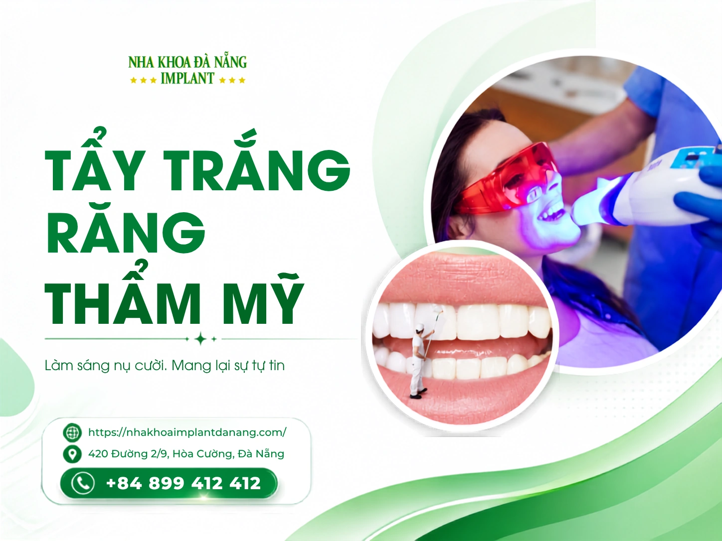 Tẩy trắng răng thẩm mỹ