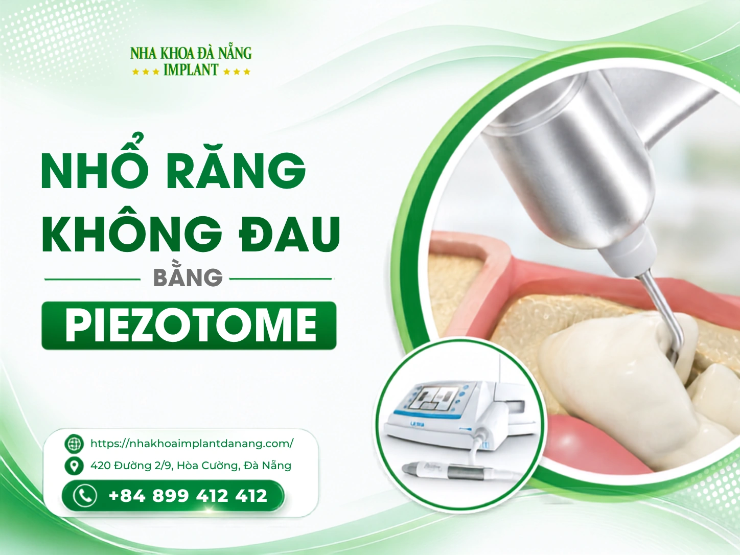 Nhổ răng không đau bằng Piezotome