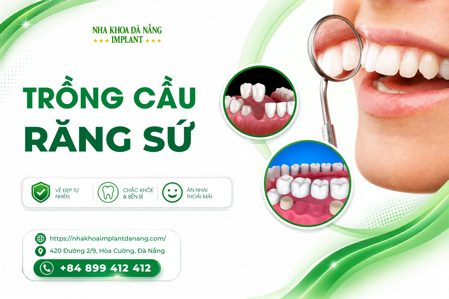 Trồng cầu răng sứ