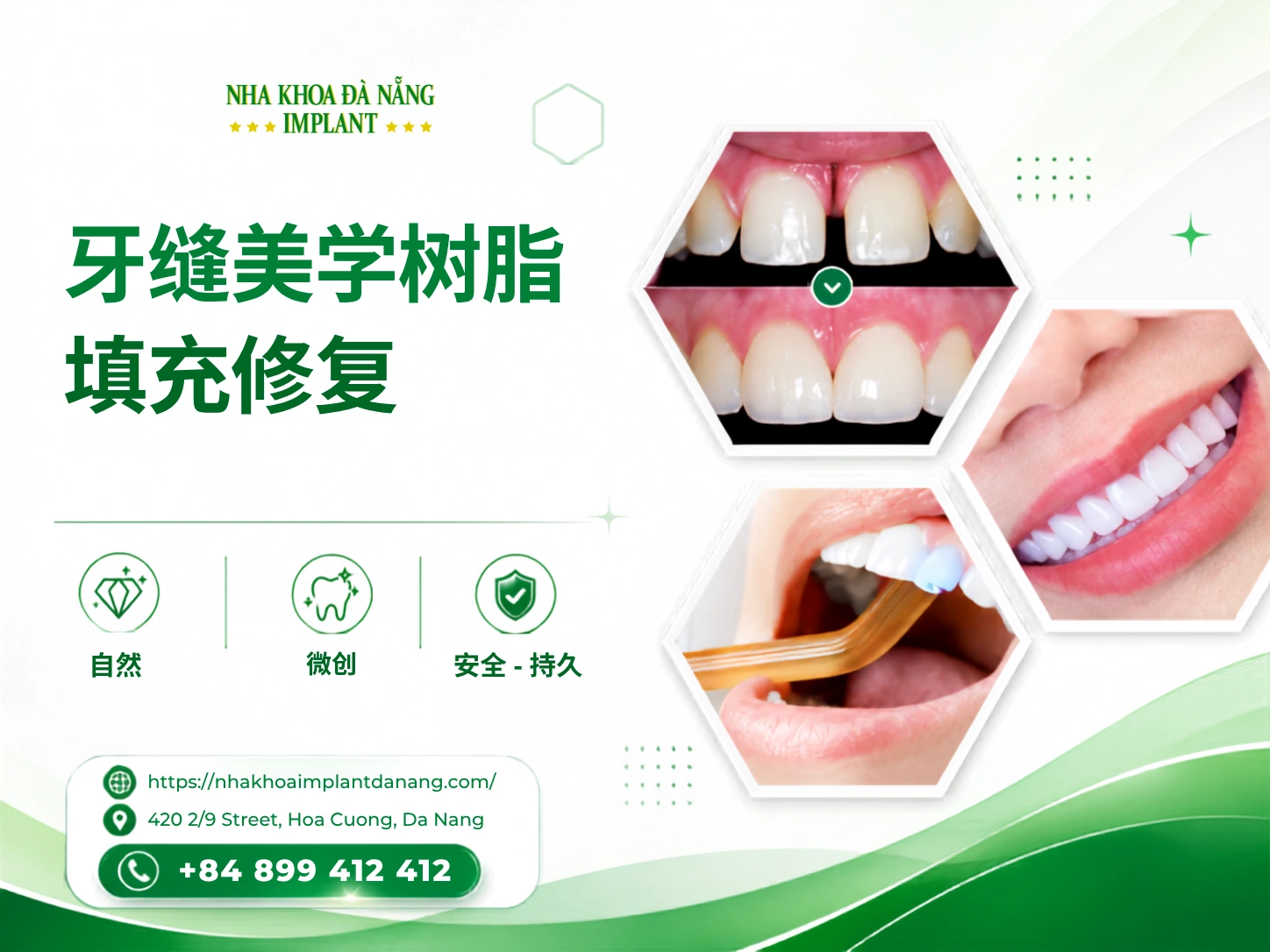 牙缝美学充填