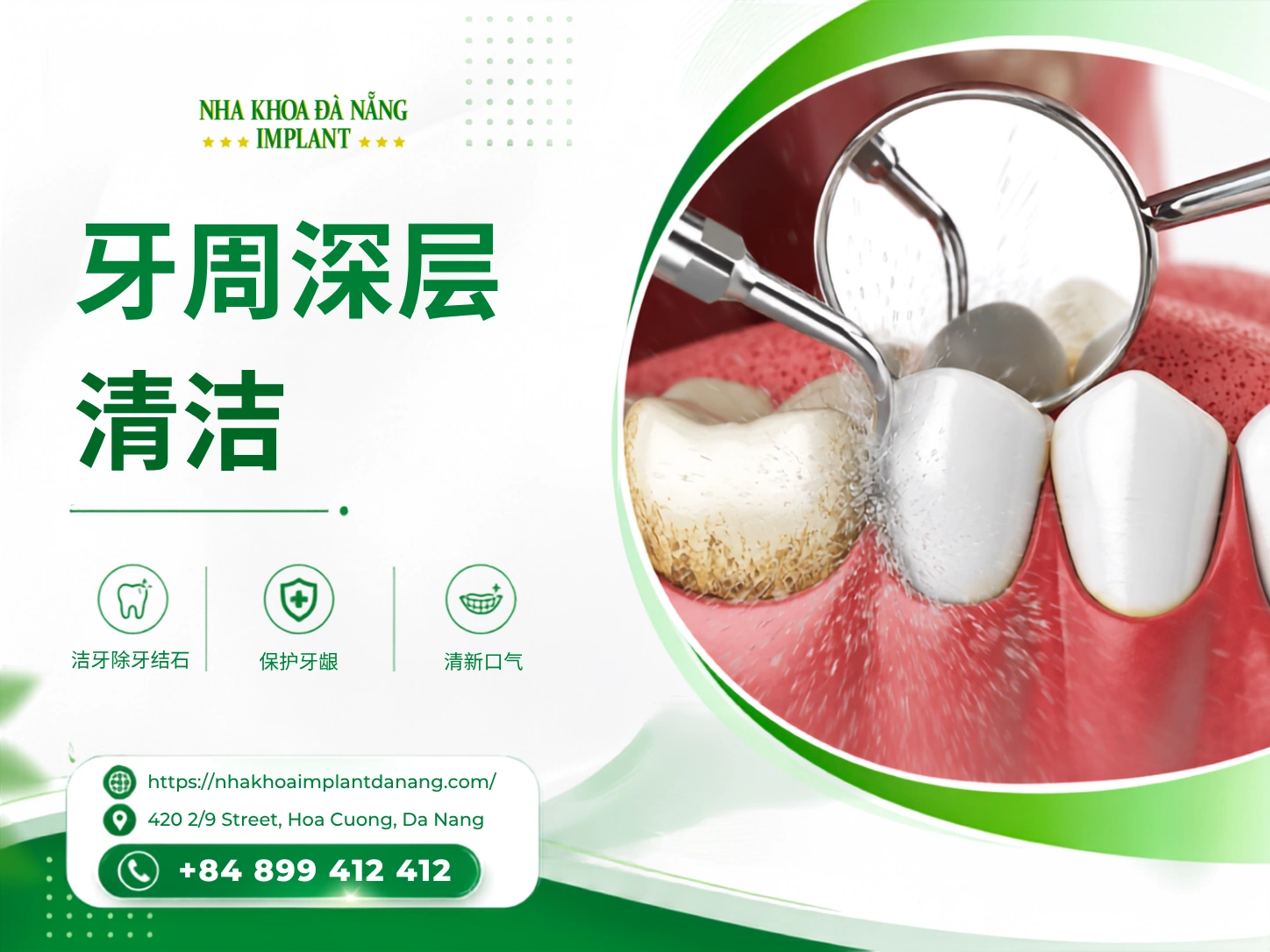 龈下刮治与根面平整