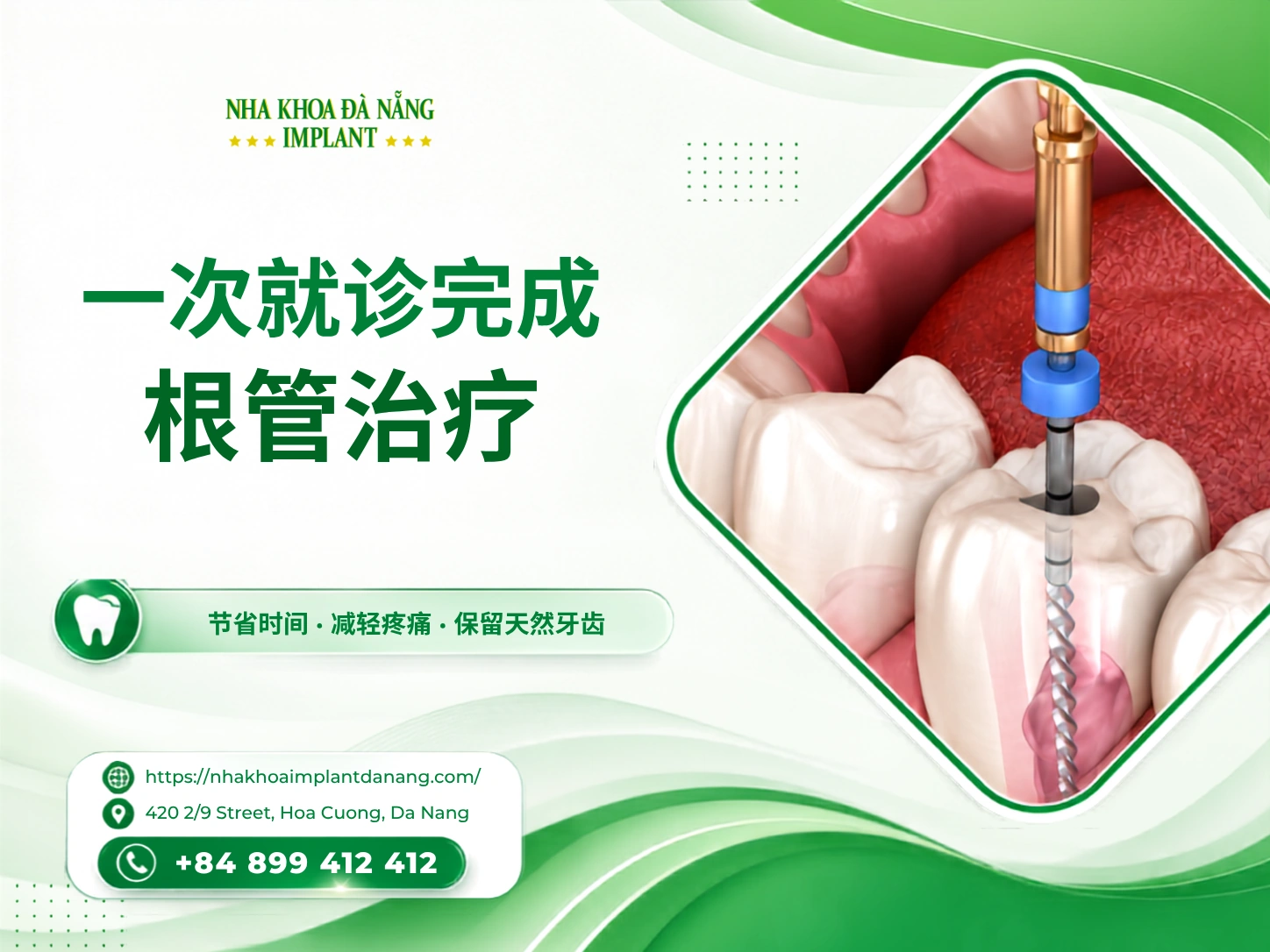 单次就诊根管治疗