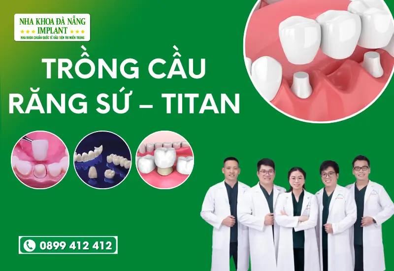 Trồng cầu răng sứ – titan