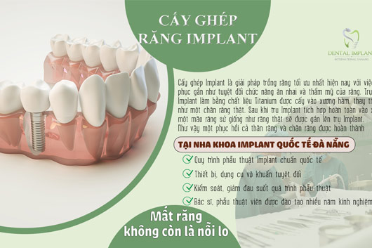 Người trung niên có trồng răng Implant được không?