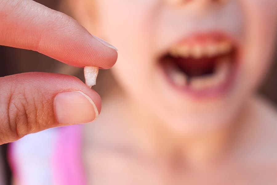 Thay răng là một phần không thể thiếu trong cuộc đời mỗi đứa trẻ