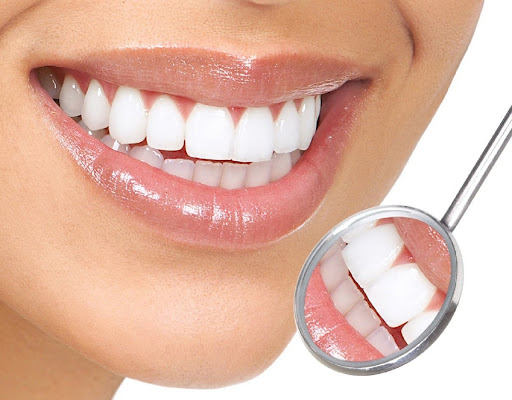 Cách phân biệt răng sứ chính hãng khi trồng răng toàn sứ