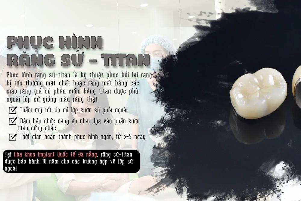 Titanium Porcelain Crowns