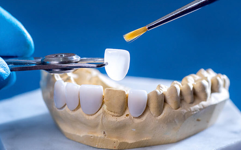 Mẻ răng có sao không? Cách khắc phục mẻ răng là gì?
