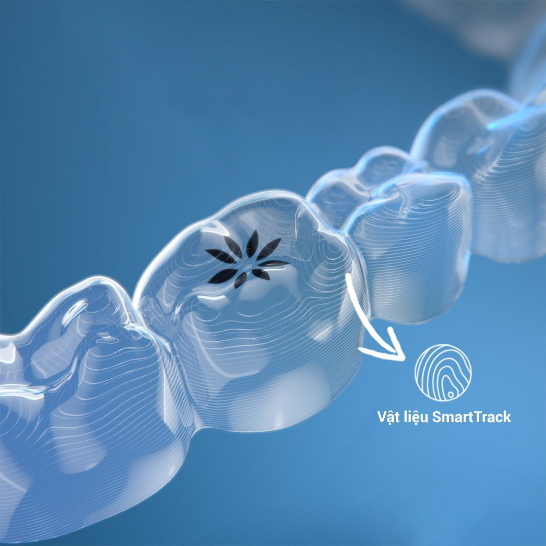 Vật liệu SmartTrack độc quyền của Invisalign tác động lực nhẹ, đều nhưng vẫn di chuyển răng hiệu quả
