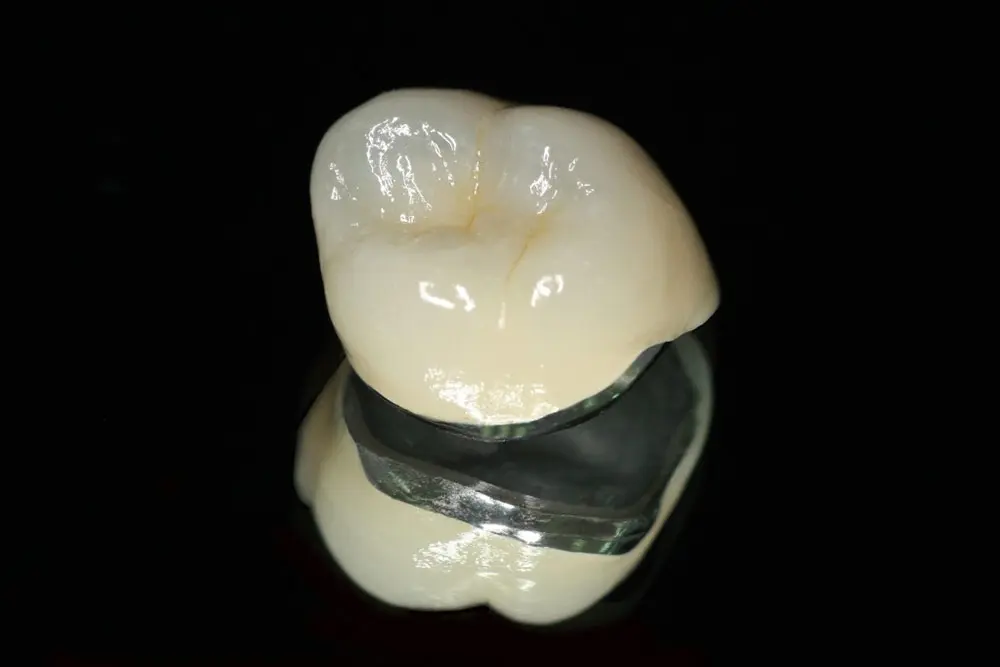 Porcelain teeth implantation in Da Nang with porcelain - titanium teeth