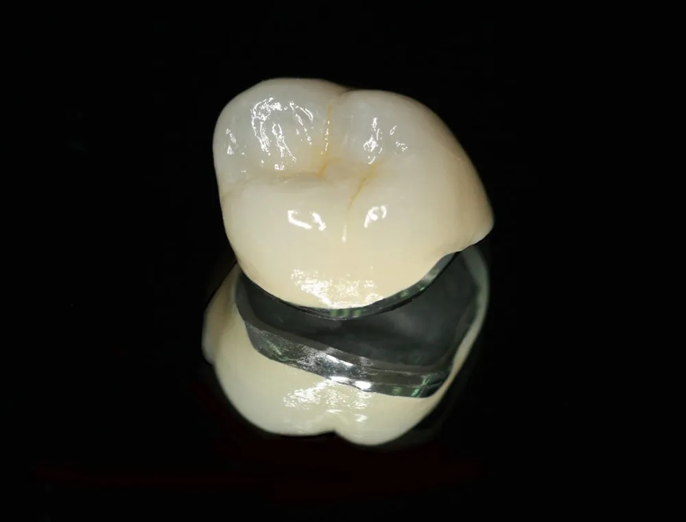 Titanium porcelain teeth are a commonly used type of porcelain teeth