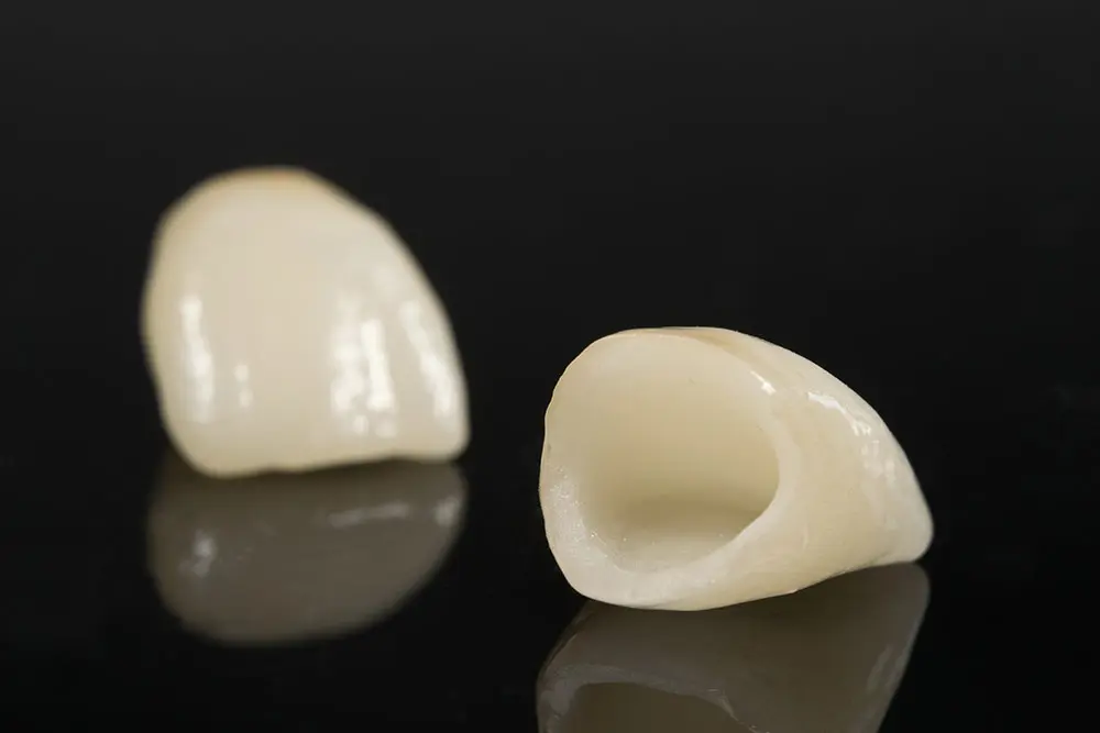 Làm răng sứ có khả năng cải thiện một phần răng thưa, răng không đều