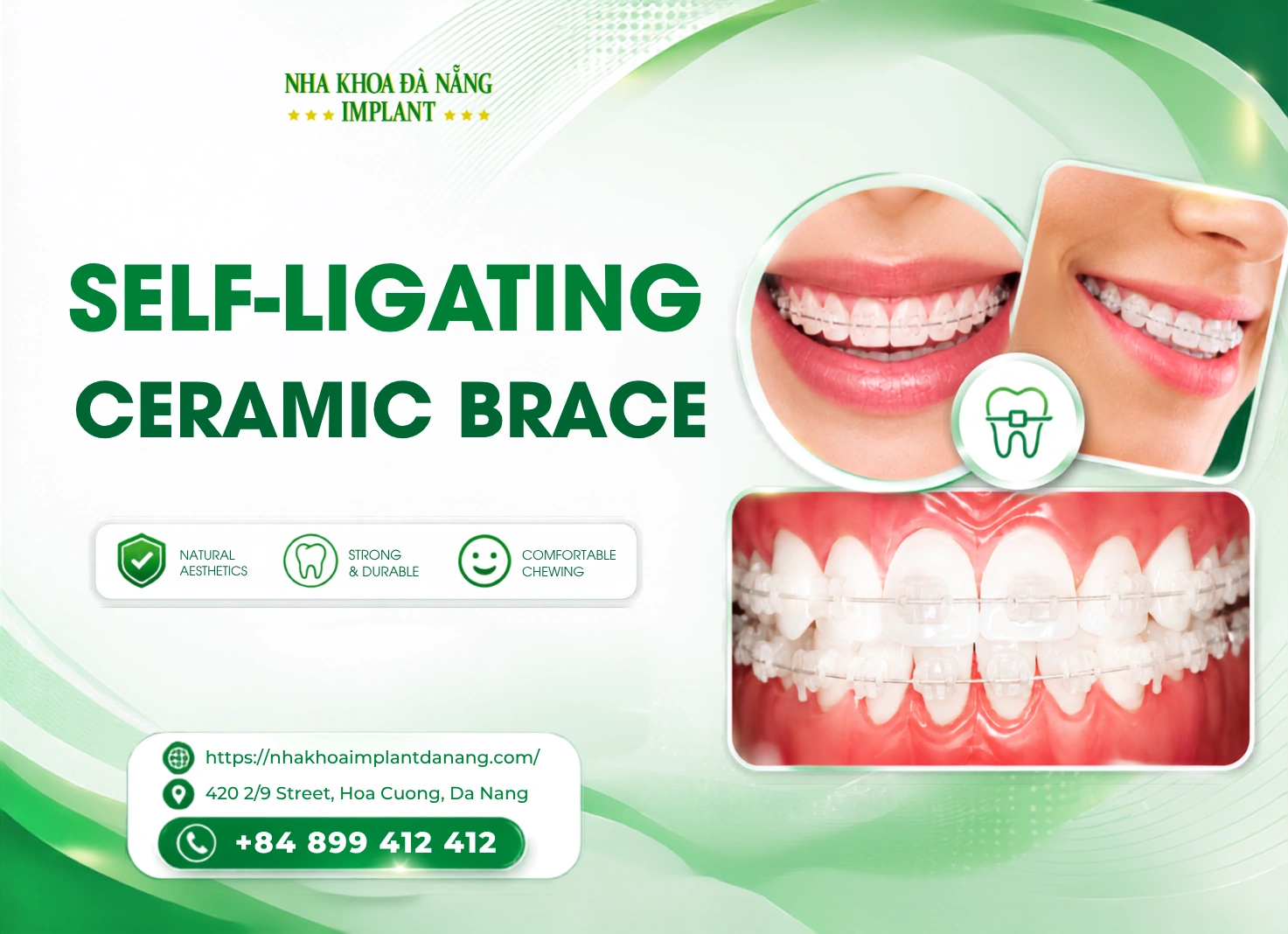 Self-ligating Ceramic Brace