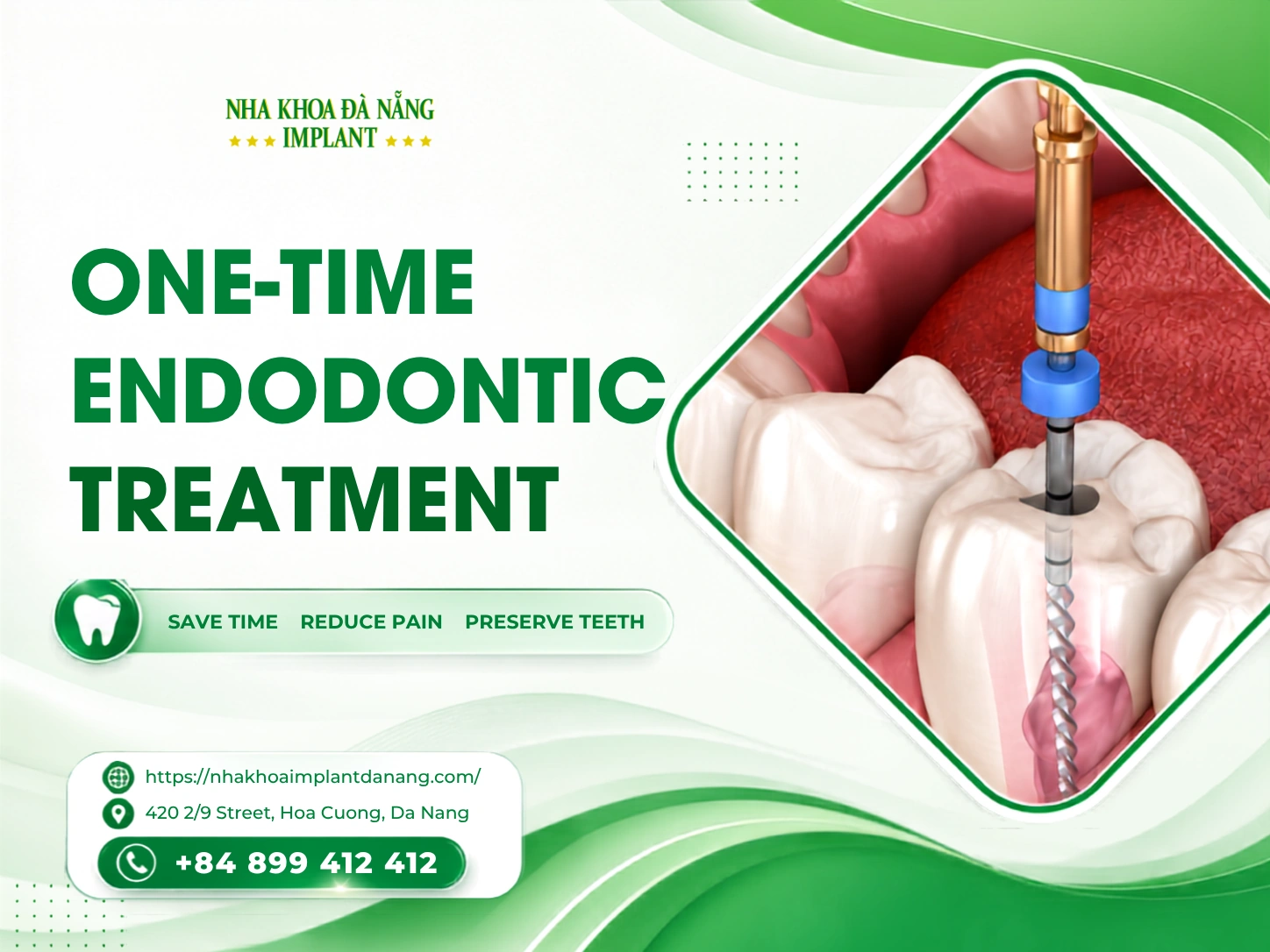 One-time endodontic treatment