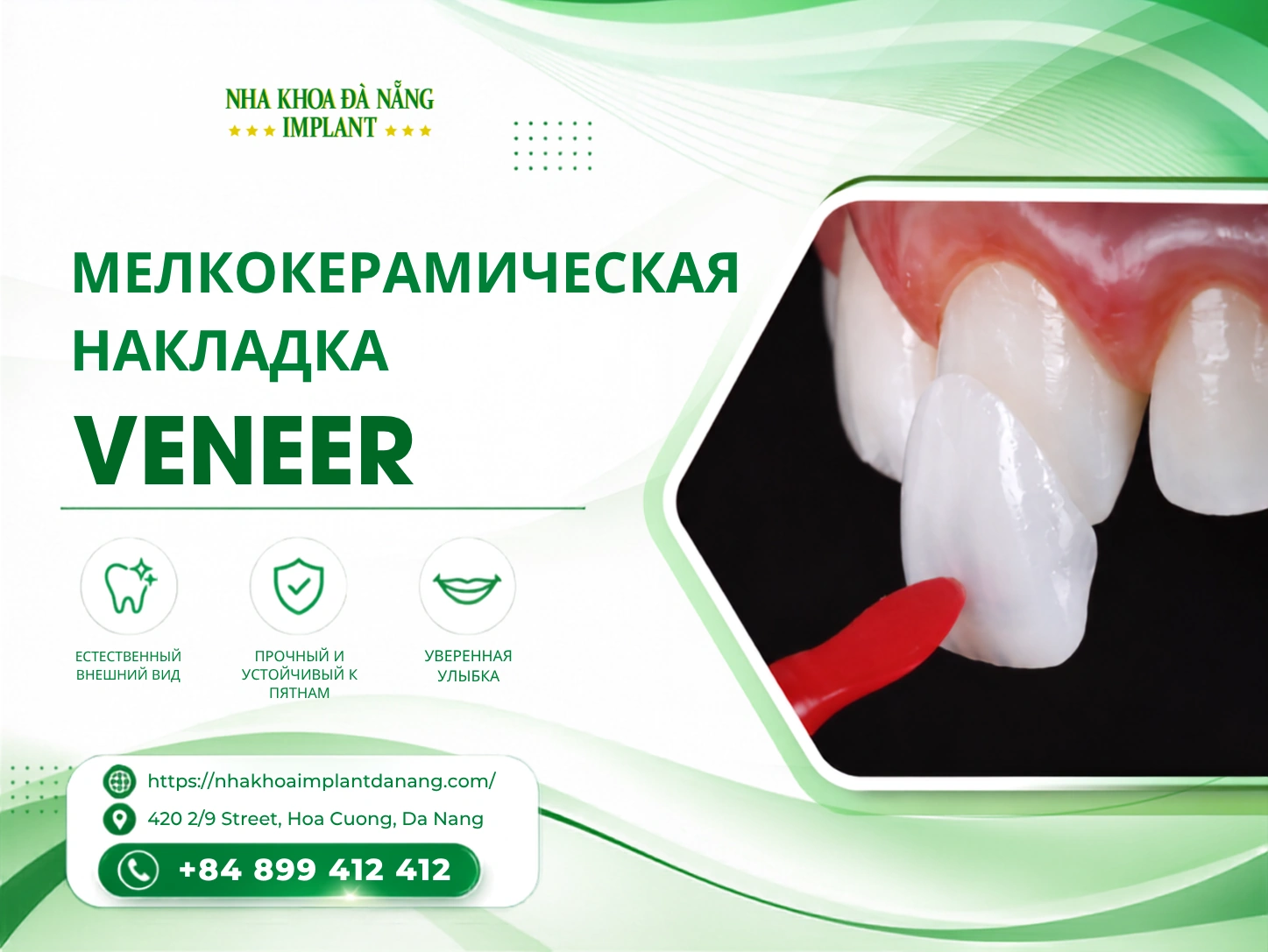 Мелкокерамическая накладка Veneer