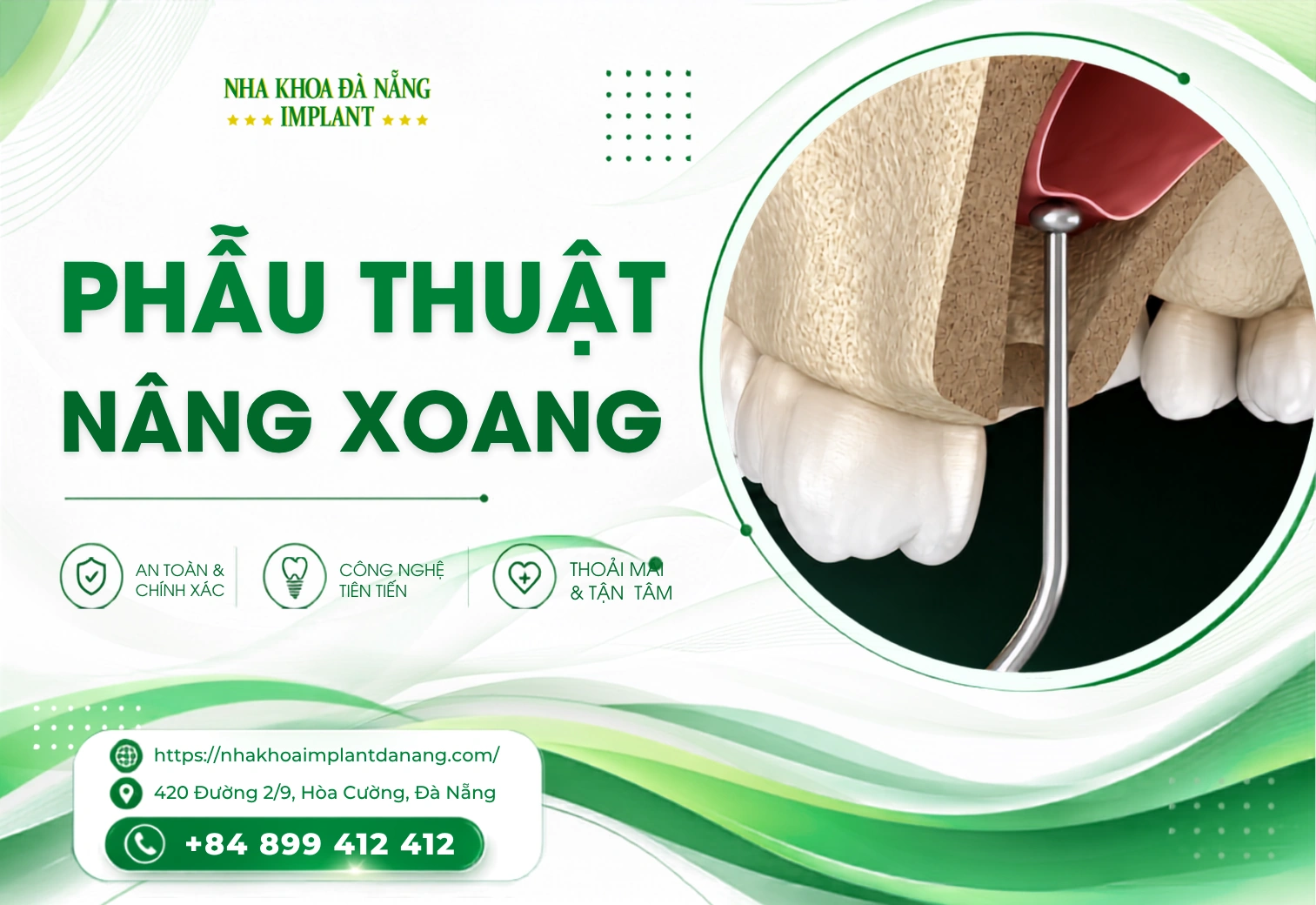 Phẫu thuật nâng xoang