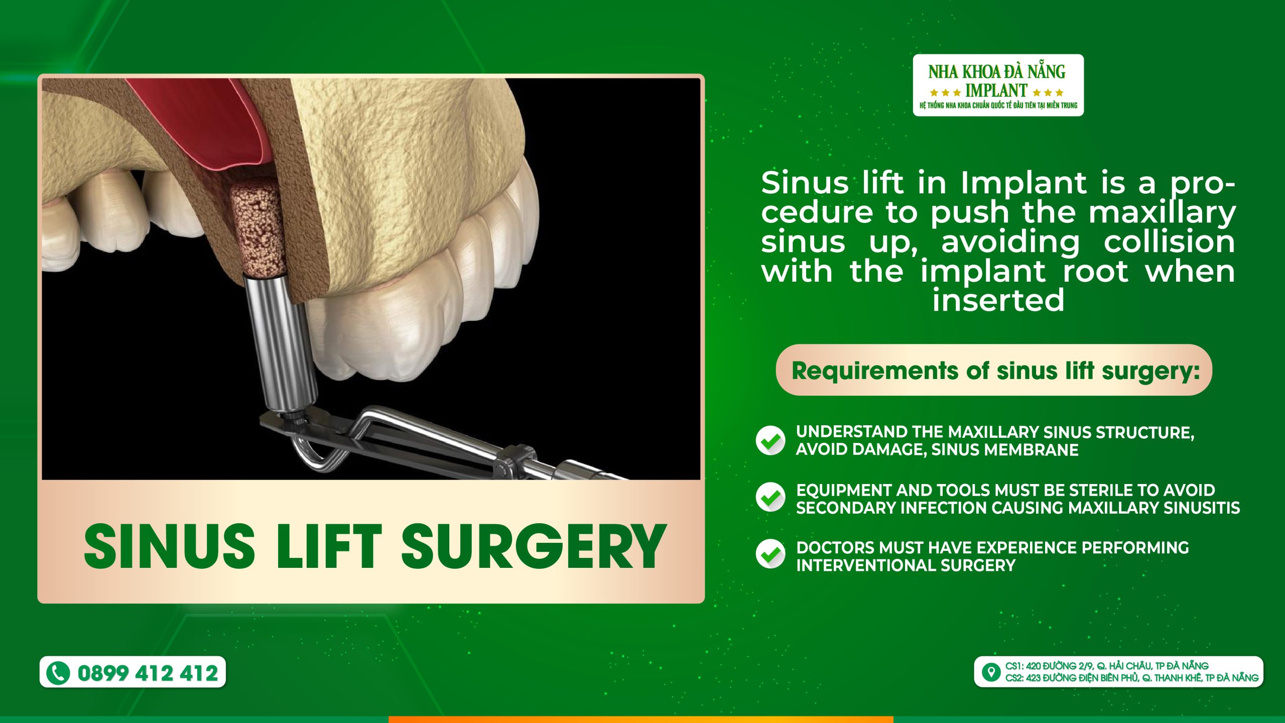 Sinus lift surgery