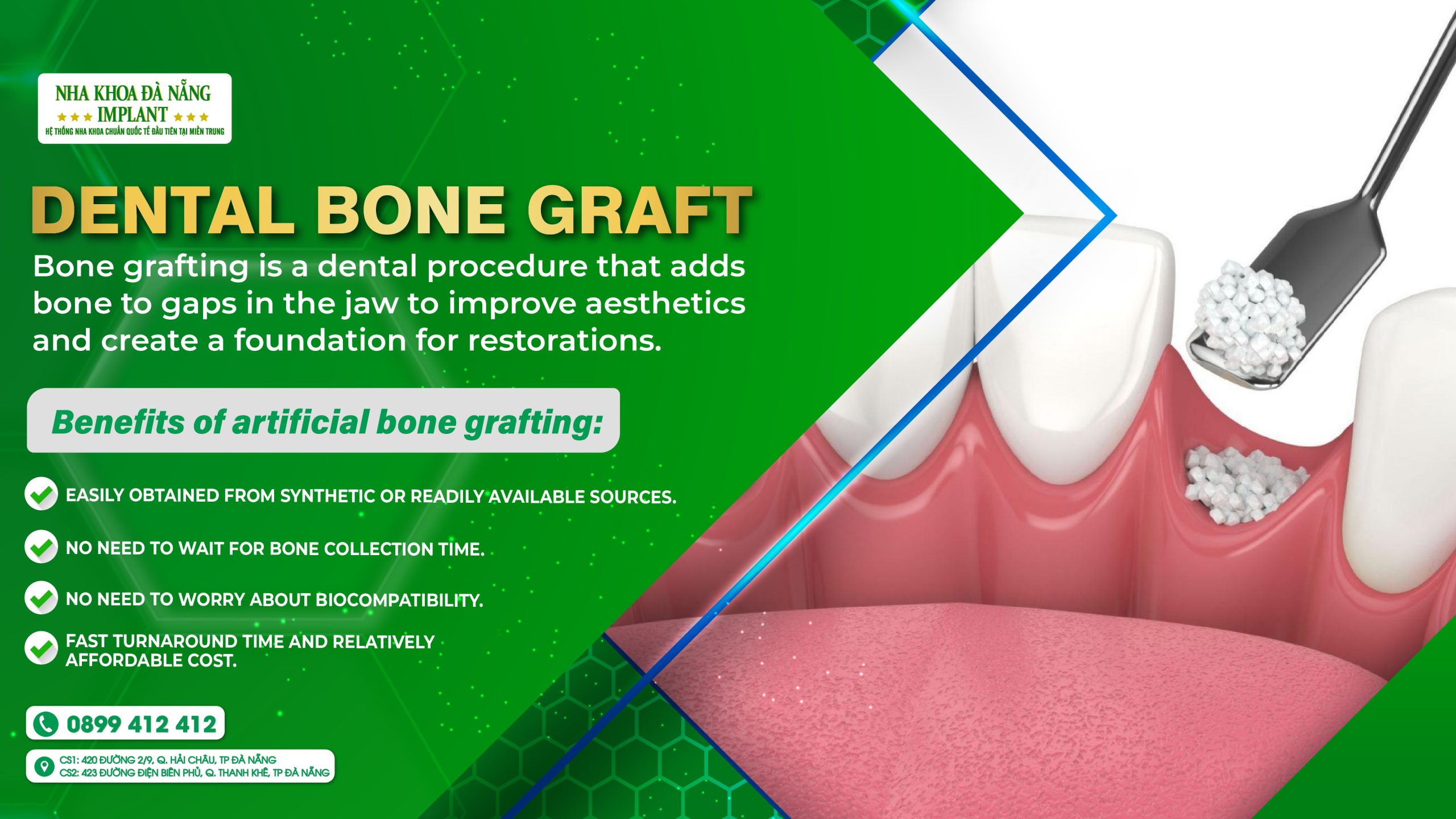 Dental bone graft