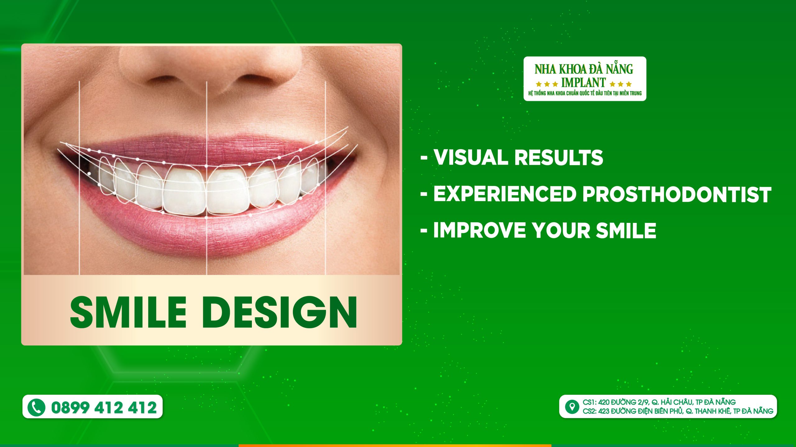 Smile design