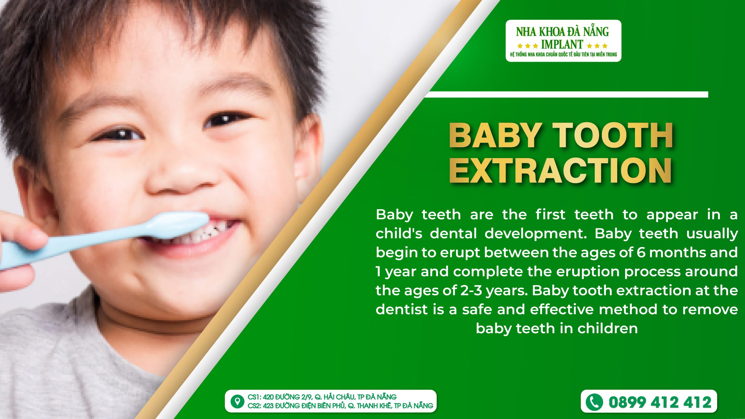 Baby Tooth Extraction