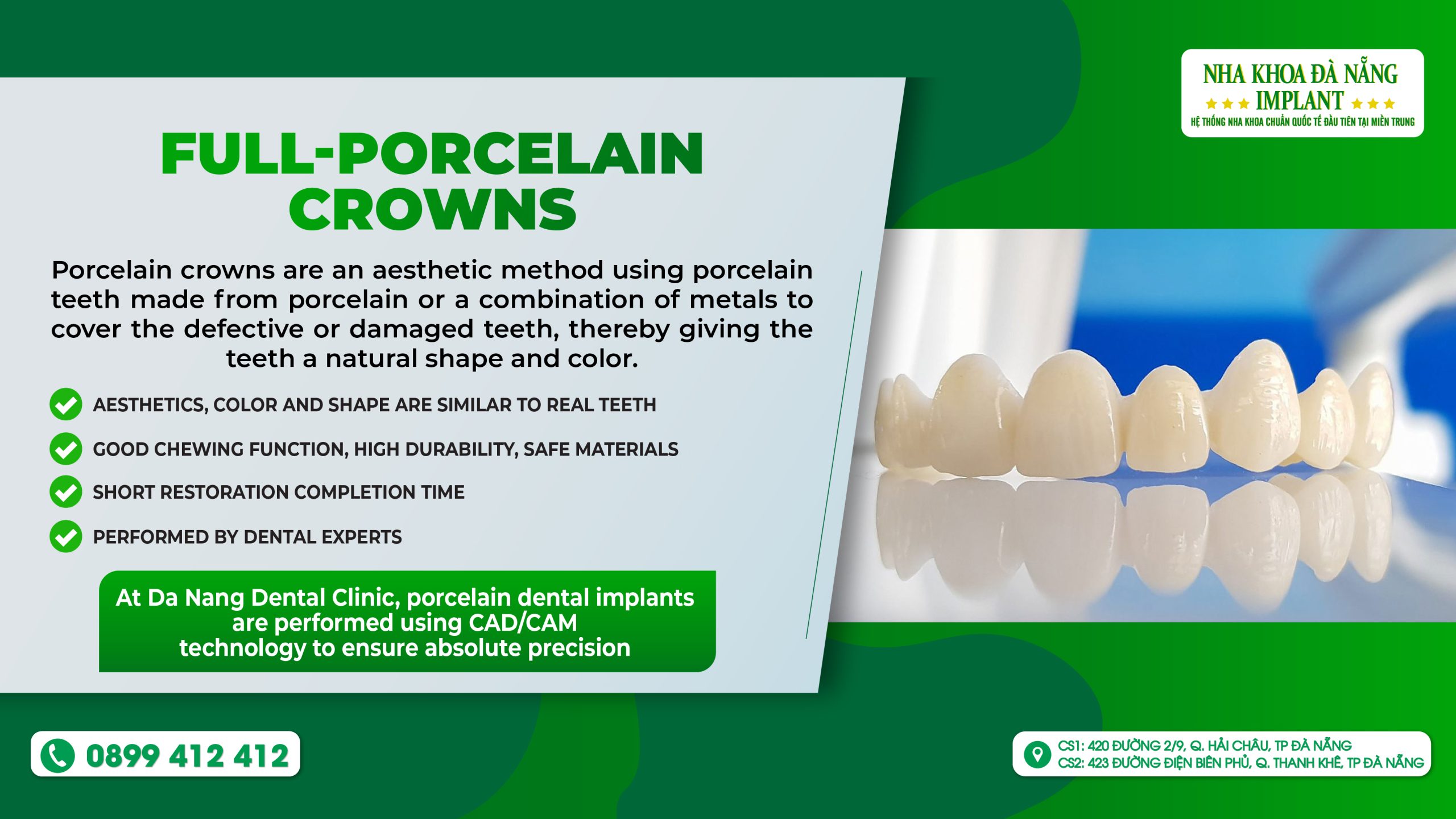 Full-porcelain crowns