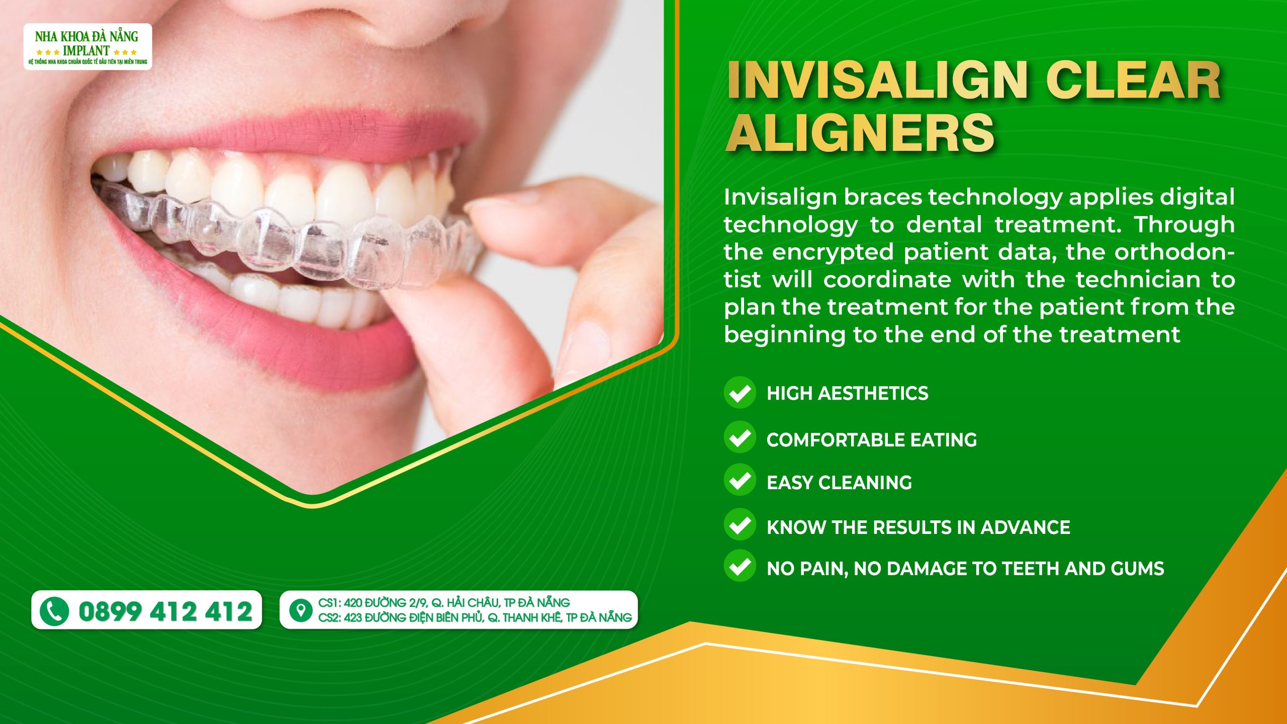 Invisalign Clear Aligners