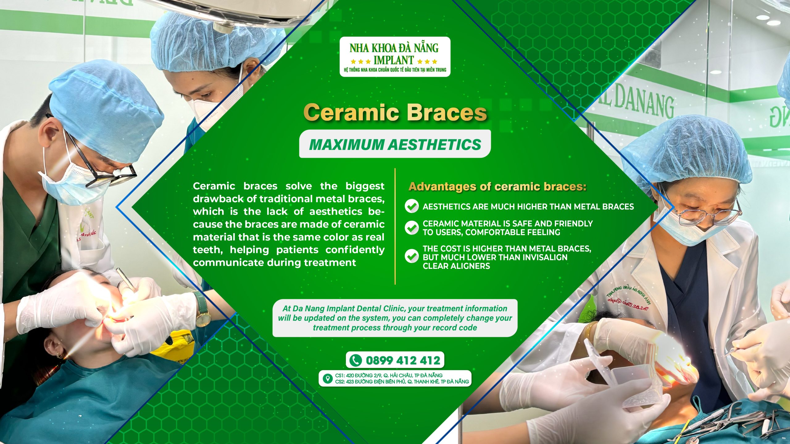 Ceramic Braces