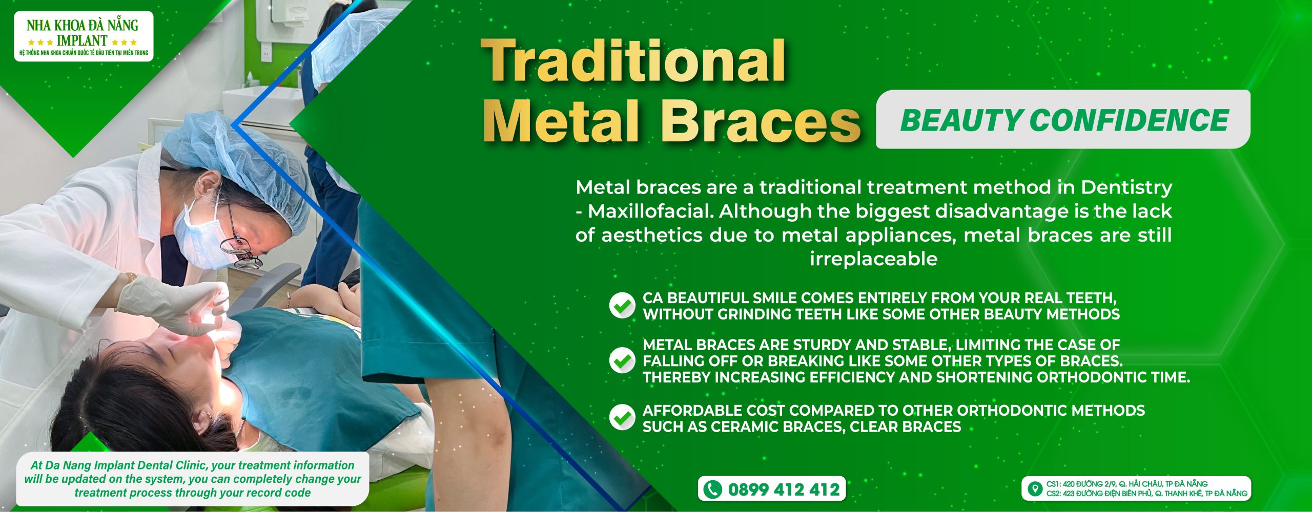 Traditional Metal Braces