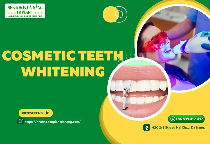 Cosmetic teeth whitening