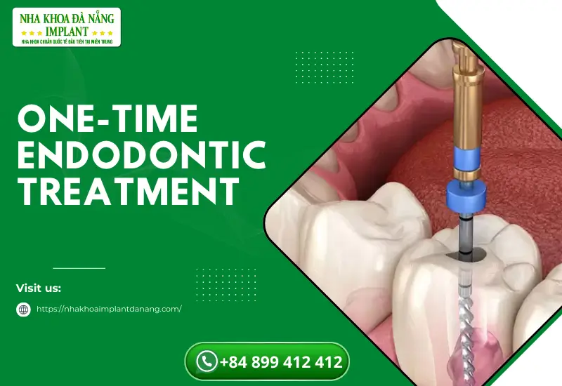 One-time endodontic treatment