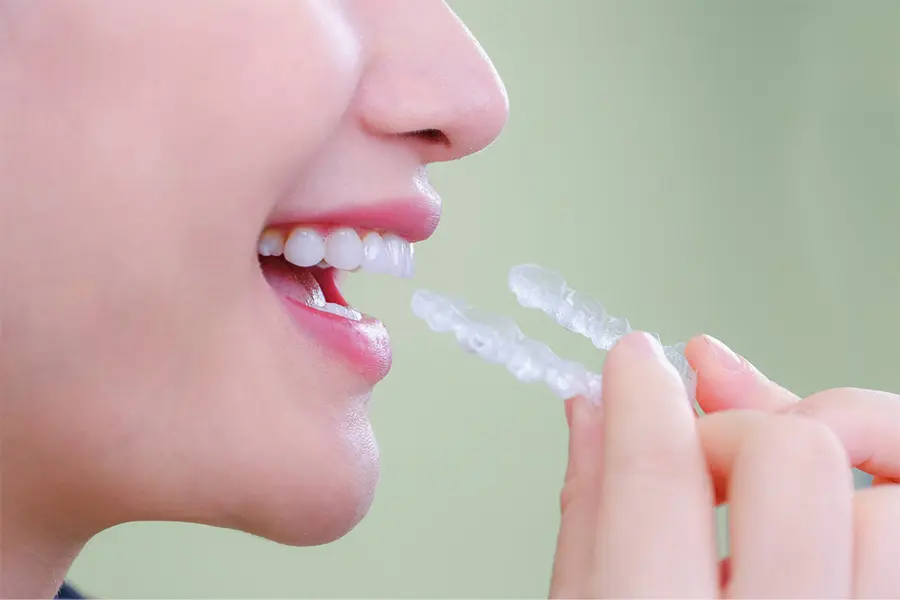 Niềng răng trong suốt Invisalign có thể gây khó chịu lúc mới đeo