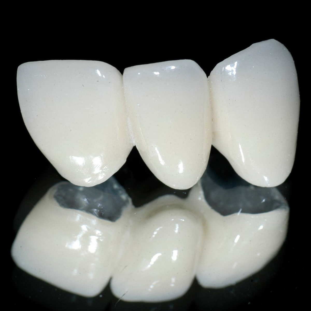 Răng toàn sứ có tương hợp sinh học tốt, trông gần giống như răng thật
