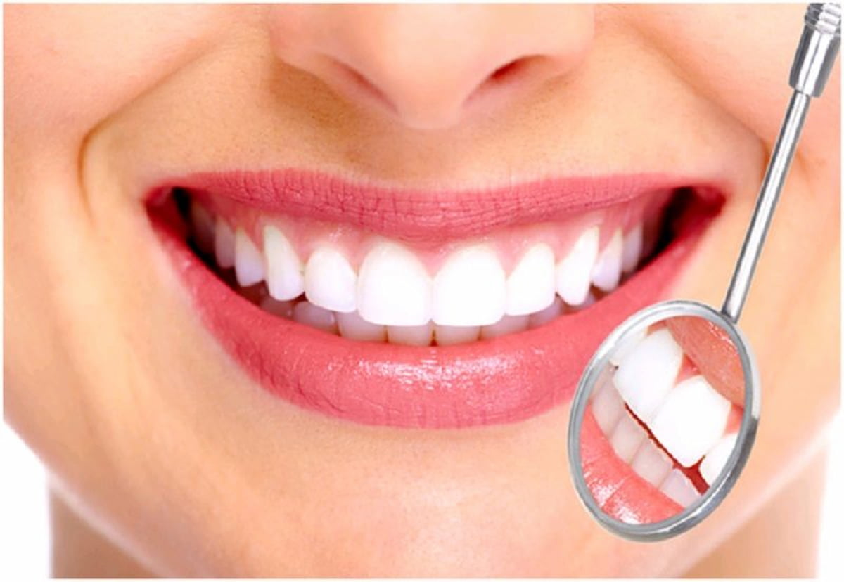 Lắp răng sứ kiêng ăn gì? Sau bao lâu thì ăn uống bình thường được?