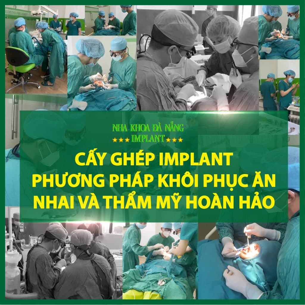 Implant cases with many doctors and assistants, to bring the best results at Da Nang Implant Dentistry