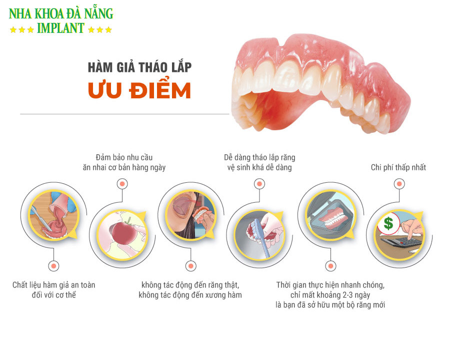 Ưu – Nhược điểm của trồng răng tháo lắp