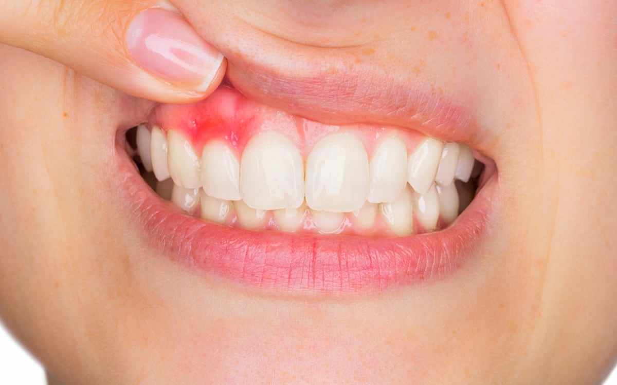 Răng bị đau khi chạm vào là bị gì? Cách xử lý