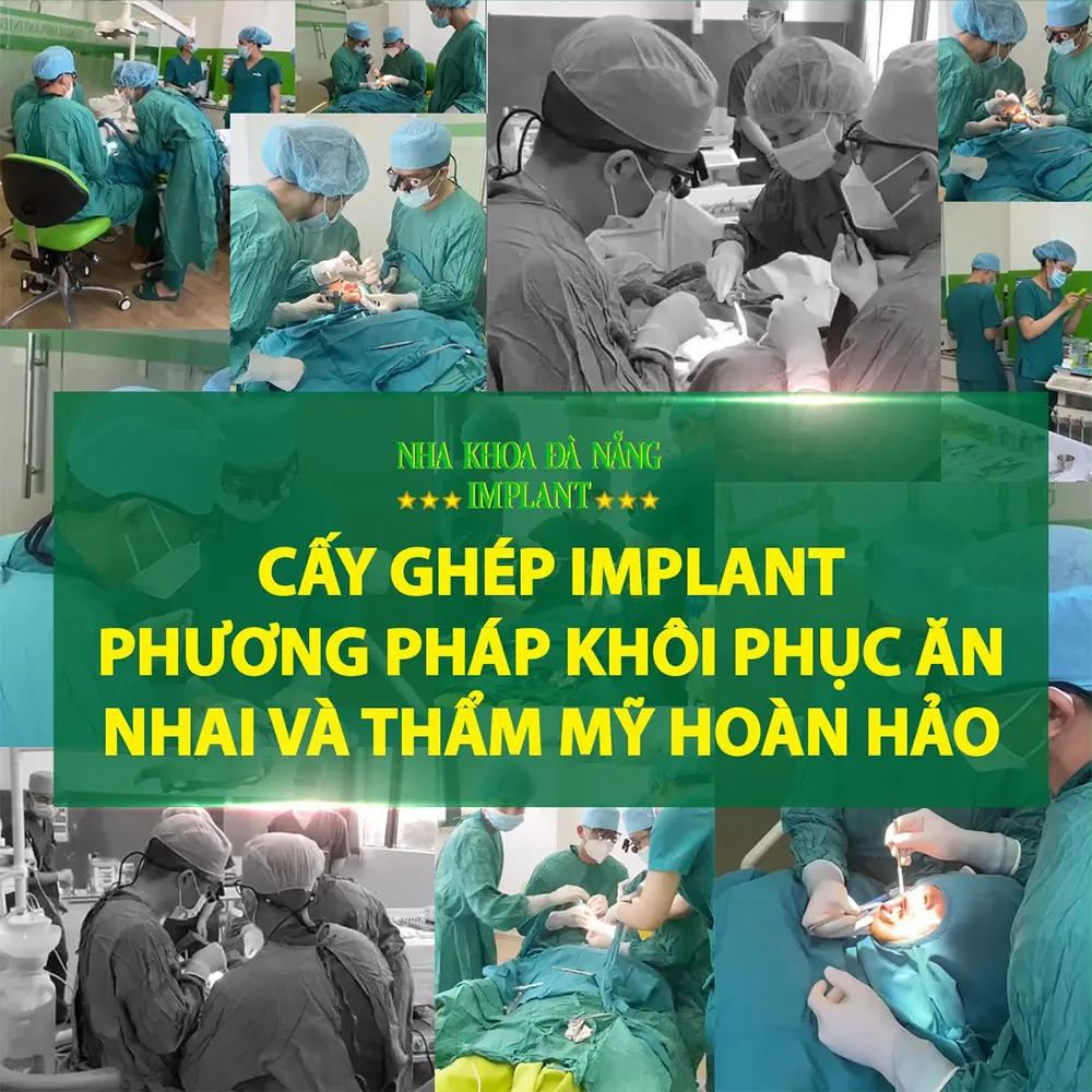 Top địa chỉ trồng răng implant uy tín tại Đà Nẵng, tư vấn miễn phí