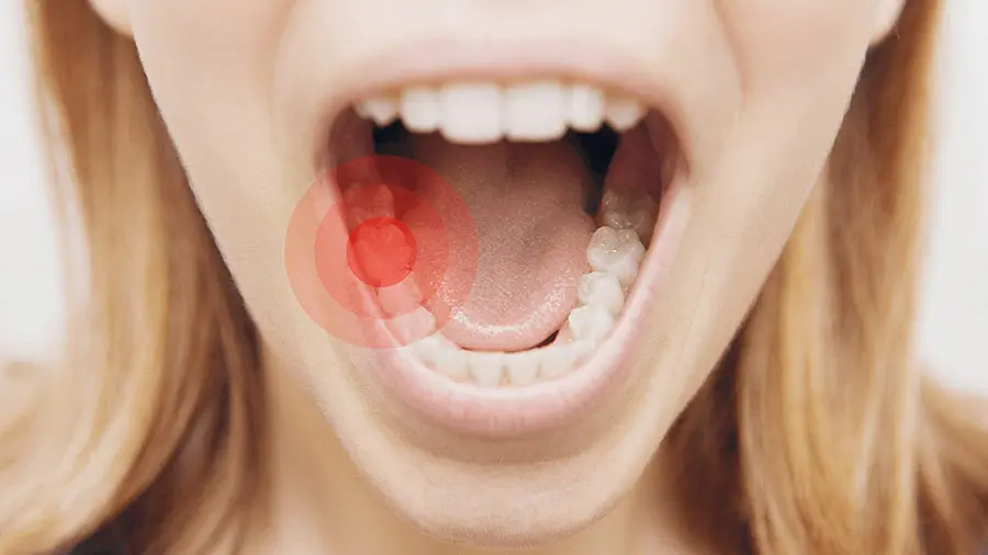 Tình trạng đau răng xuất phát từ nhiều nguyên nhân