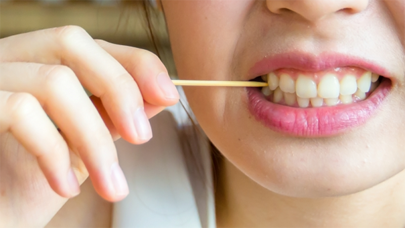 Hở chân răng là gì? Hở chân răng có nguy hiểm không?