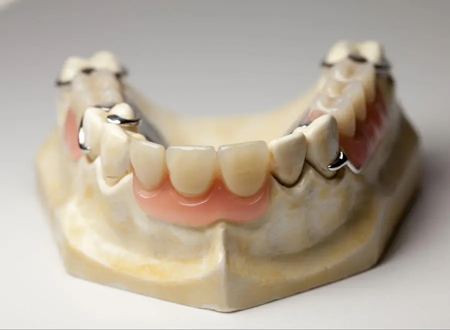 This method helps preserve real teeth