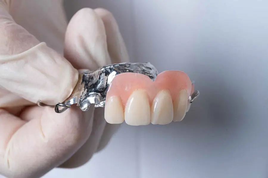 Implant removable front teeth